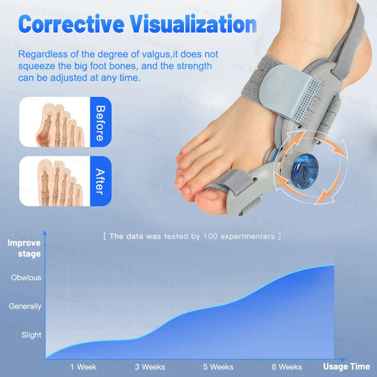 ToeAlign® – Orthopedic Correction for Greater Comfort.