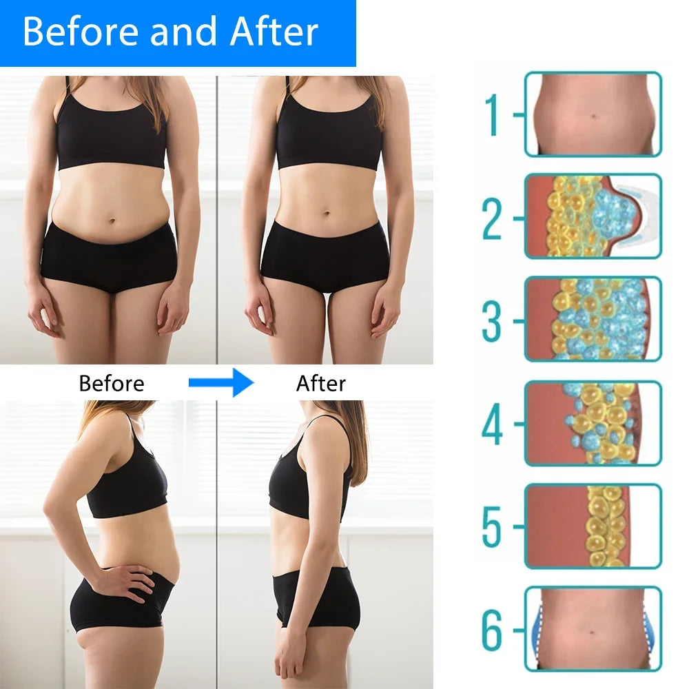 CryoSlim® – Fat Reduction with Cryotherapy Technology.